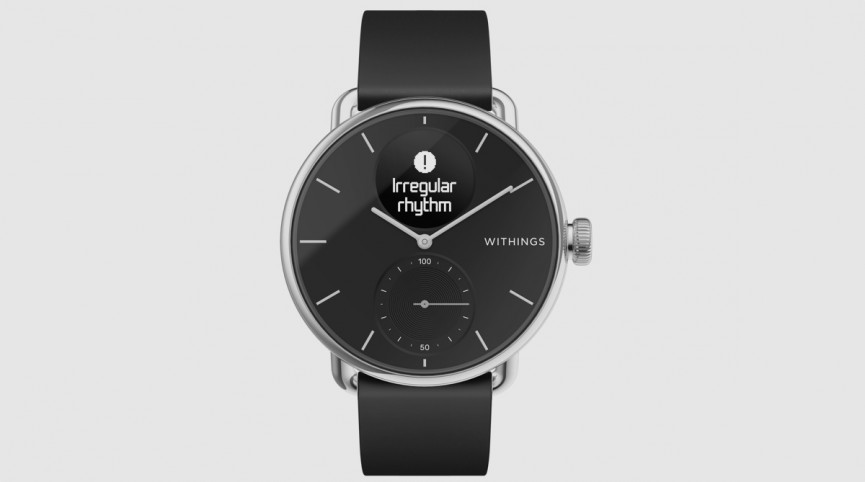 withings scanwatch ecg